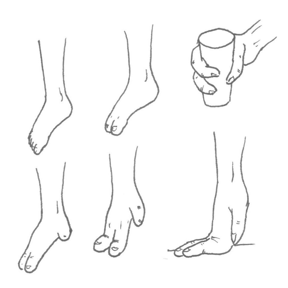 Mientras mis pechos crecian, notaba una extraña sensacion tambien en mis pies. Y cuando me fije en detalle, me pude dar cuenta de que mis dedos se estaban fundiendo.... ya empece a pensar que era victima de una mutacion espontanea, seguramente debida al accidente de mis padres, y que no serian las unicas transformaciones que sufriria. Me resigne a esperar lo peor. Pero conforme la transformacion se iva desarrollando, pude ver como se formaban en mis pies dos grupos de dedos. A los 4 dias, ya tenia bien definidos dos dedos, totalmente funcionales, de 10cm de longitud, y del tobillo empezaba a crecer una protuberancia, que al final acabaria siendo un tercer dedo. 7 dias despues ya podia decir que mis pies se habian transformado en una especie de “manos”, con 3 dedos. Me costo bastante acostumbrarme a moverlos, y controlarlos, pero en cuanto aprendi, me resultaron muy utiles. Podia coger cosas con muchisima facilidad, y manipularlas, y para mi asombro, tenia mucha precision en mis movimientos. Tambien pude comprobar que era mucho mas elastica que antes, ahora podia mover mis piernas como nunca lo habia hecho, y en unas direcciones que muchas contorsionistas ya hubieran deseado.
