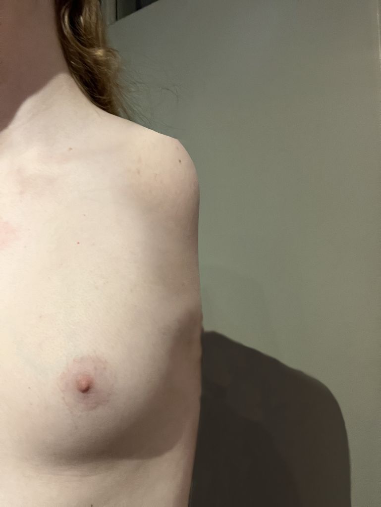 5226_2result
Keywords: armless